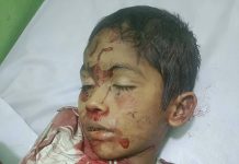 এমপি আলমগীর ফরিদ এর গাড়ী বহরের চাপায় ঝরে গেল শিশুর তাজা প্রাণ।